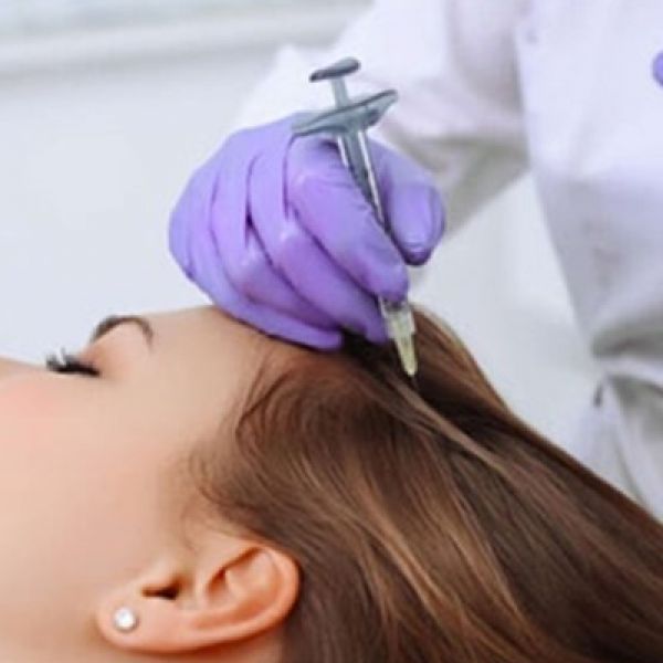 Mesoterapia Capilar
