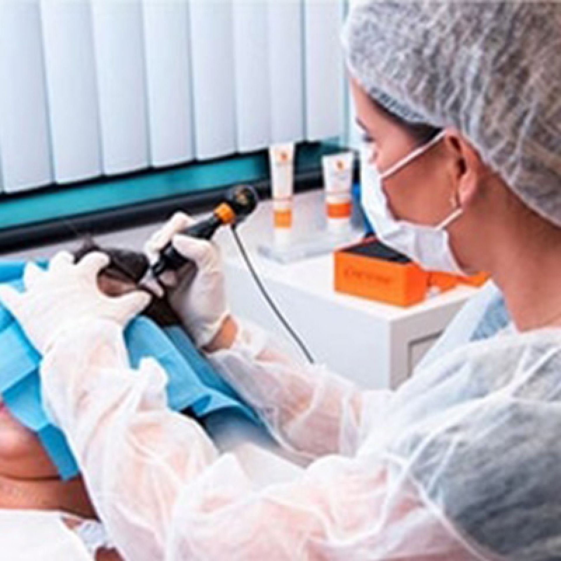 Microinfusão de Medicamentos na Pele - MMP Face e Estrias