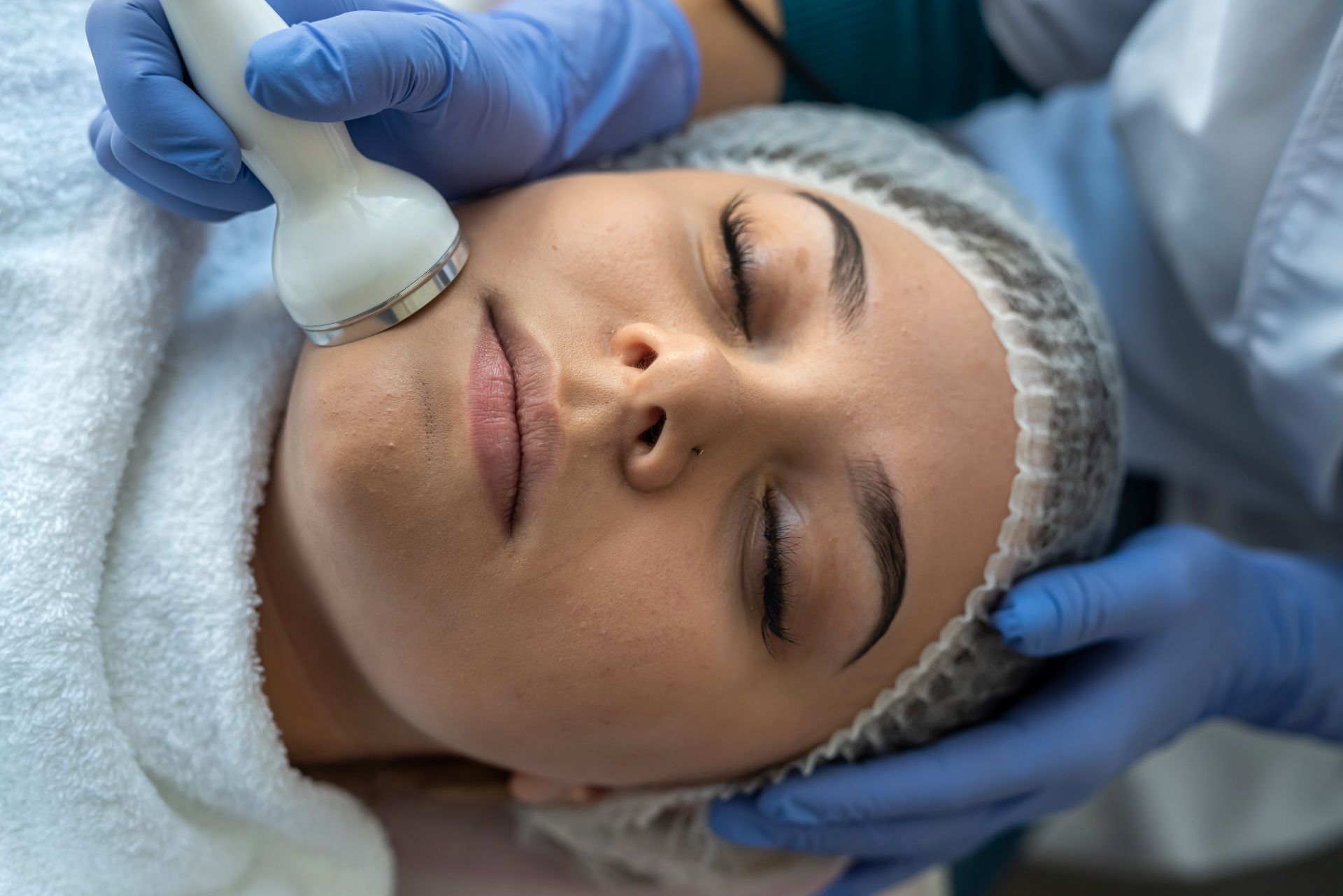 Ultrassom Microfocado – Ulthera