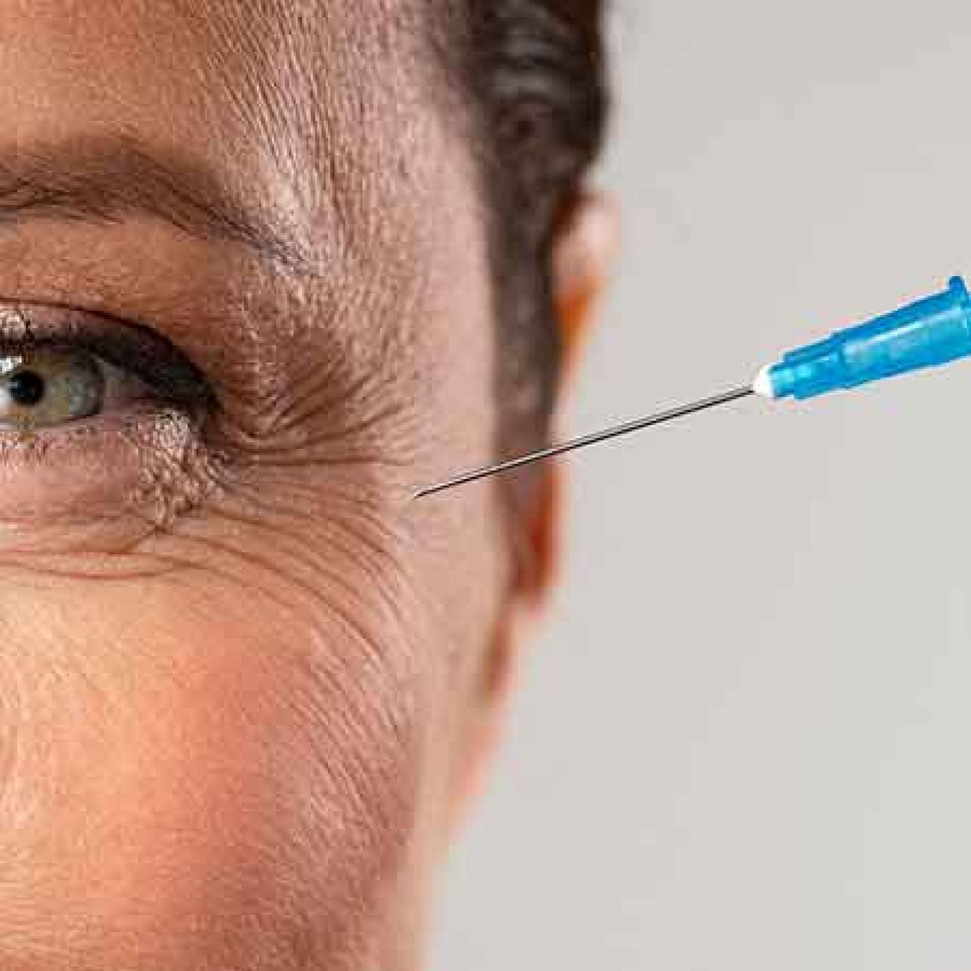 Botox para Rejuvenescimento