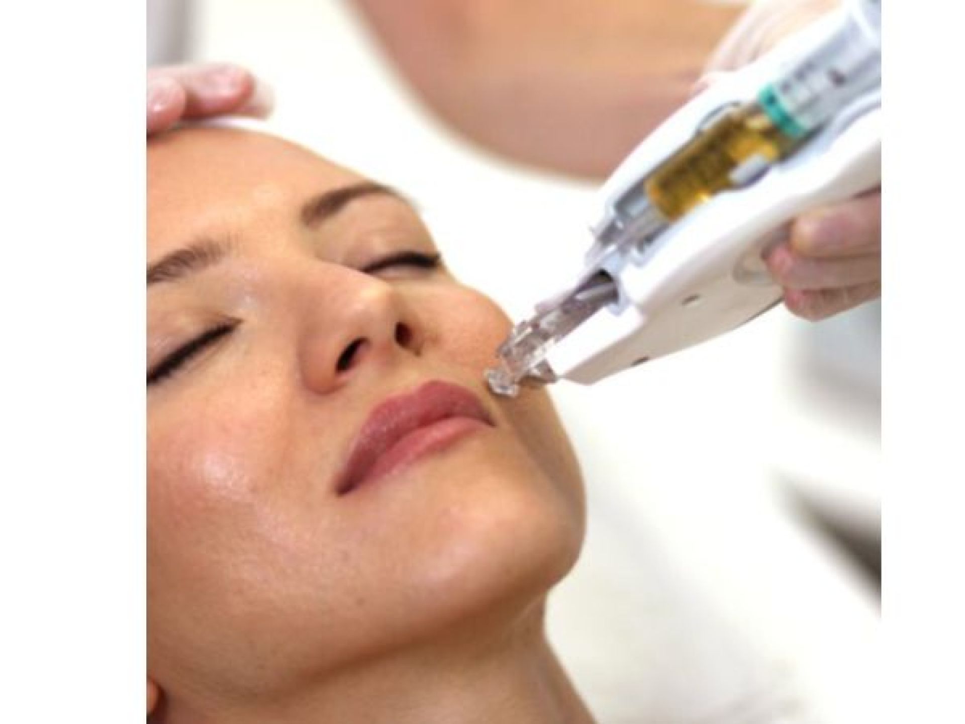 Eletroporação - Mesoject